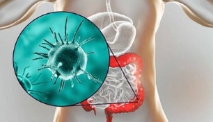 what tests to do for parasites