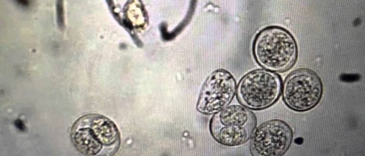 protozoan parasite cells