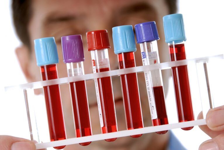 Blood test for the diagnosis of helminthiasis