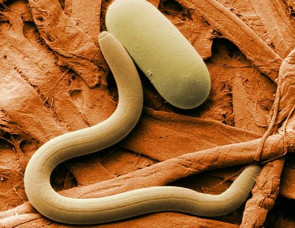 what nematodes look like