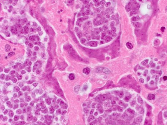 Parasitic research in a person