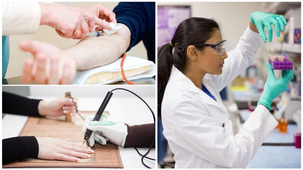 Diagnostic methods for detecting parasites in the body