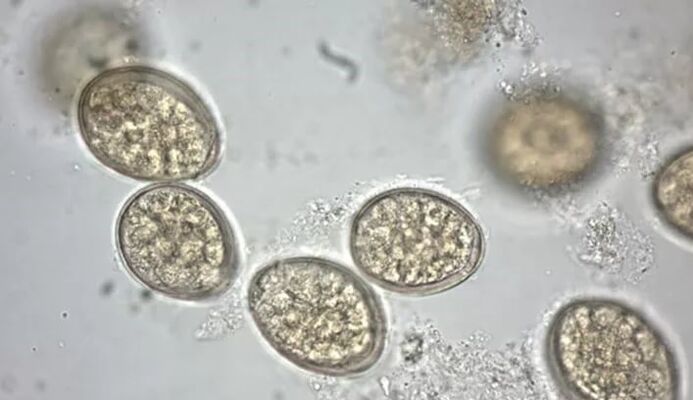 parasites under a microscope