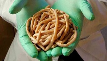 Body parasitic elimination methods