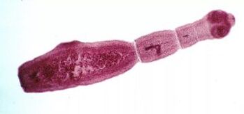 How to get rid of parasites in the human body