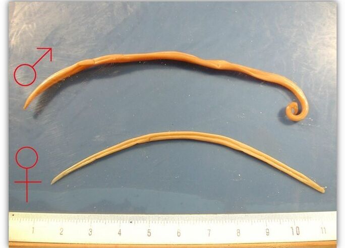 Size of roundworms - worms that infect the respiratory tract of adults