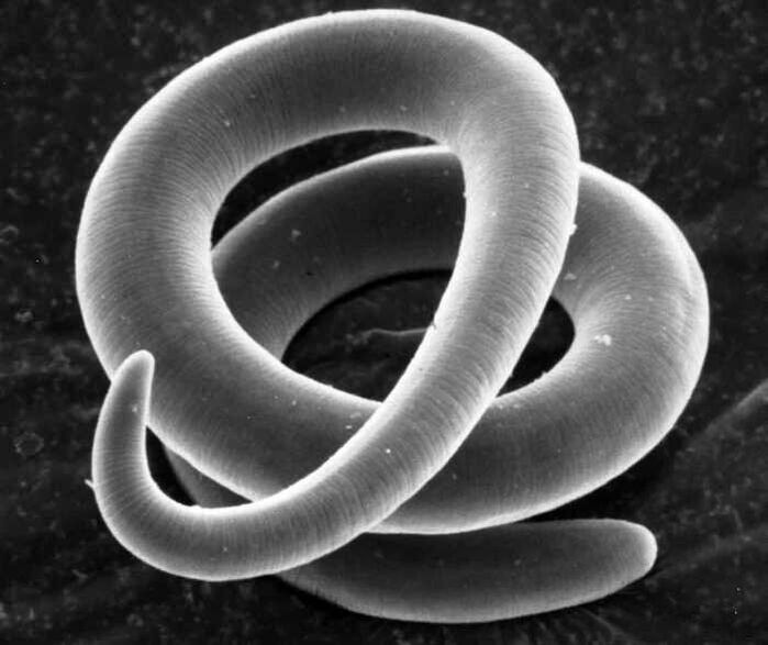 Trichinella under a microscope